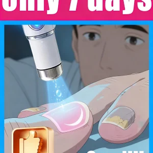 2025 latest version nail care laser pen, repairs nails.