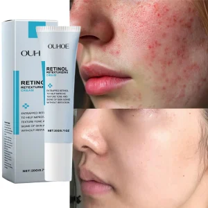 Facial Redness Repair Cream Improve Sensitive Skin Dryness
