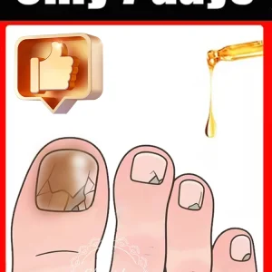 Toenail Fungus Waterproof Patch